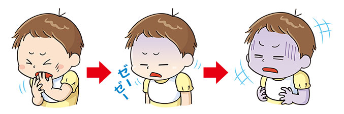 乳幼児が窒息したときの症状の例。口に指を入れる、呼吸が苦しそうになっている、顔色が急に青くなる、など。